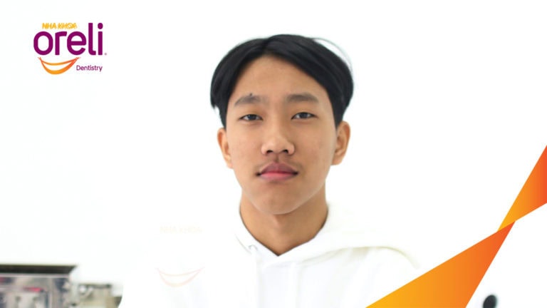 Niềng chỉnh lệch cằm sang phải