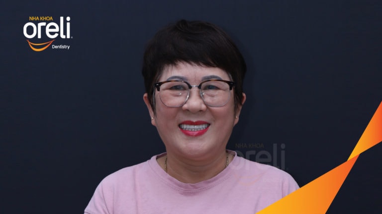 cay ghep implant toan ham tren veneer nha khoa oreli