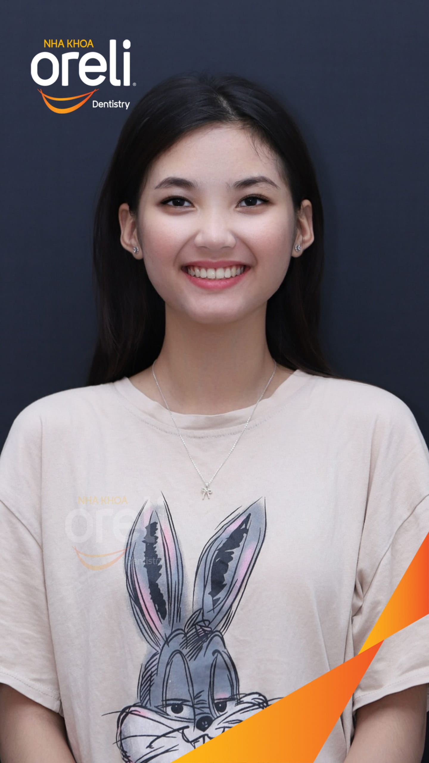 nieng rang chen chuc nha khoa oreli uy tin daklak