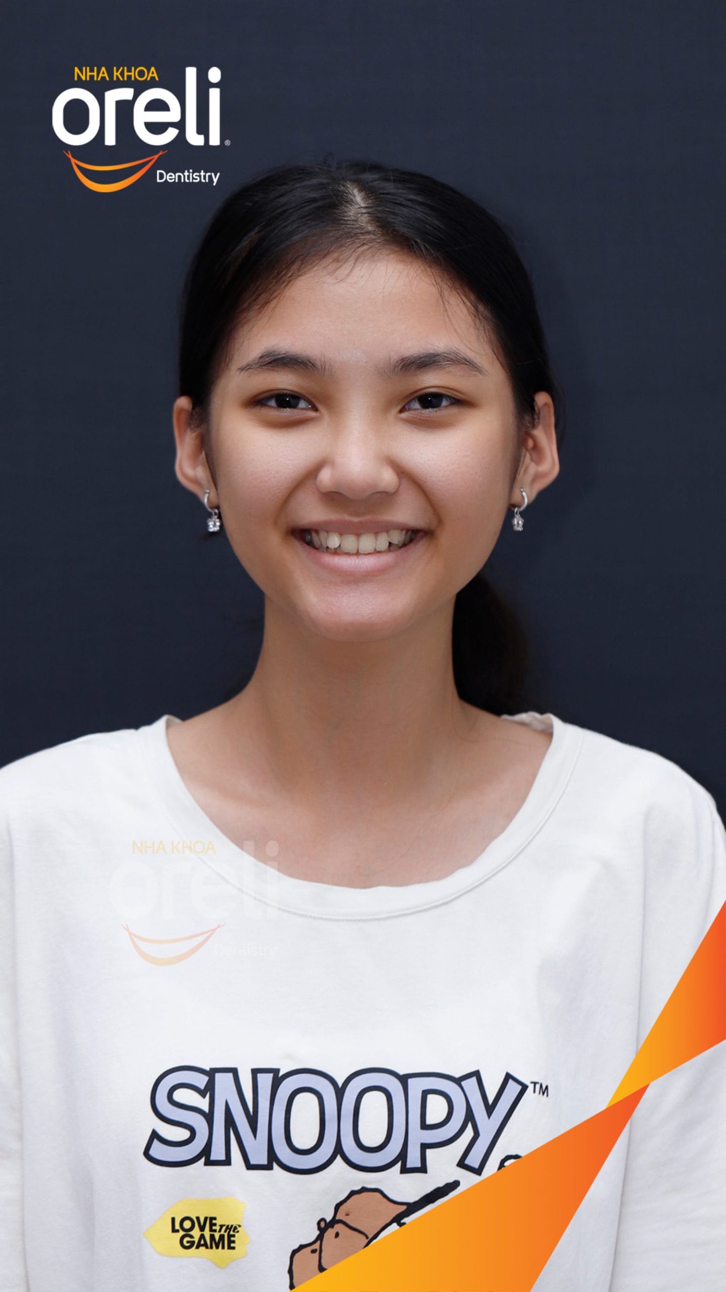 nieng rang chen chuc nha khoa oreli uy tin daklak