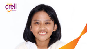 nieng rang ho chinh nha uy tin daklak nha khoa oreli