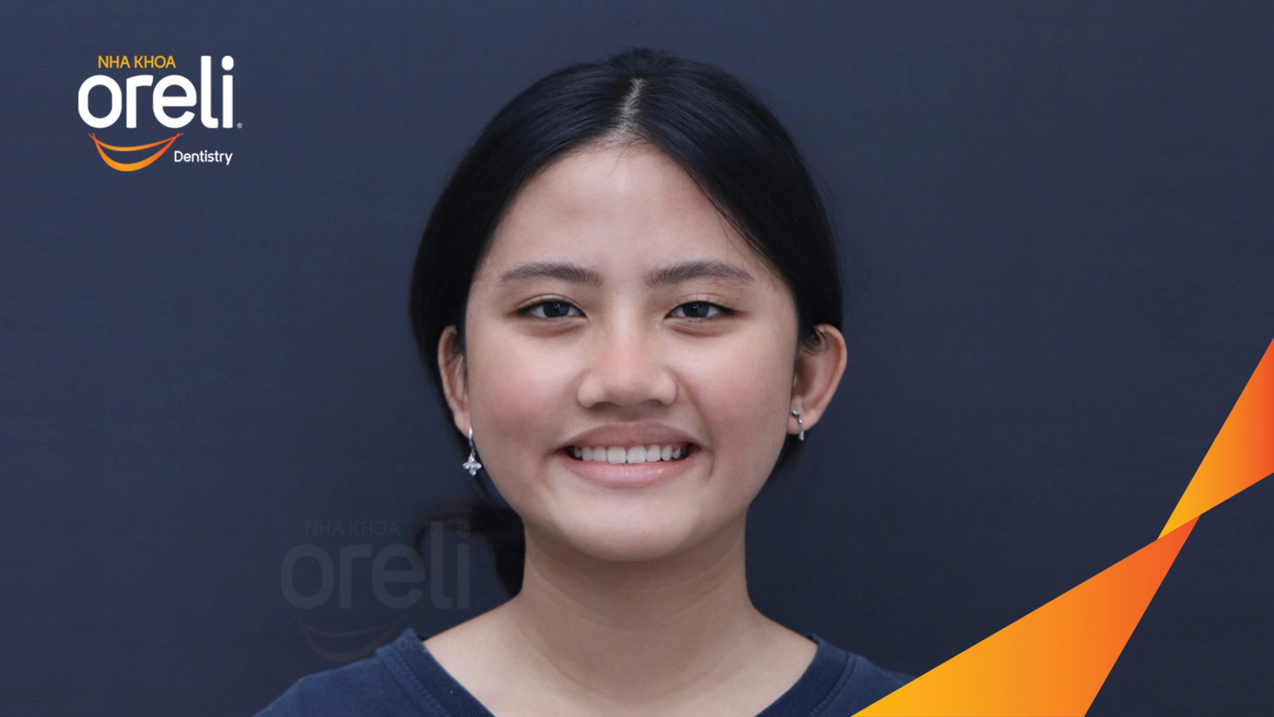Thực hiện  kéo dài  tại Oreli
