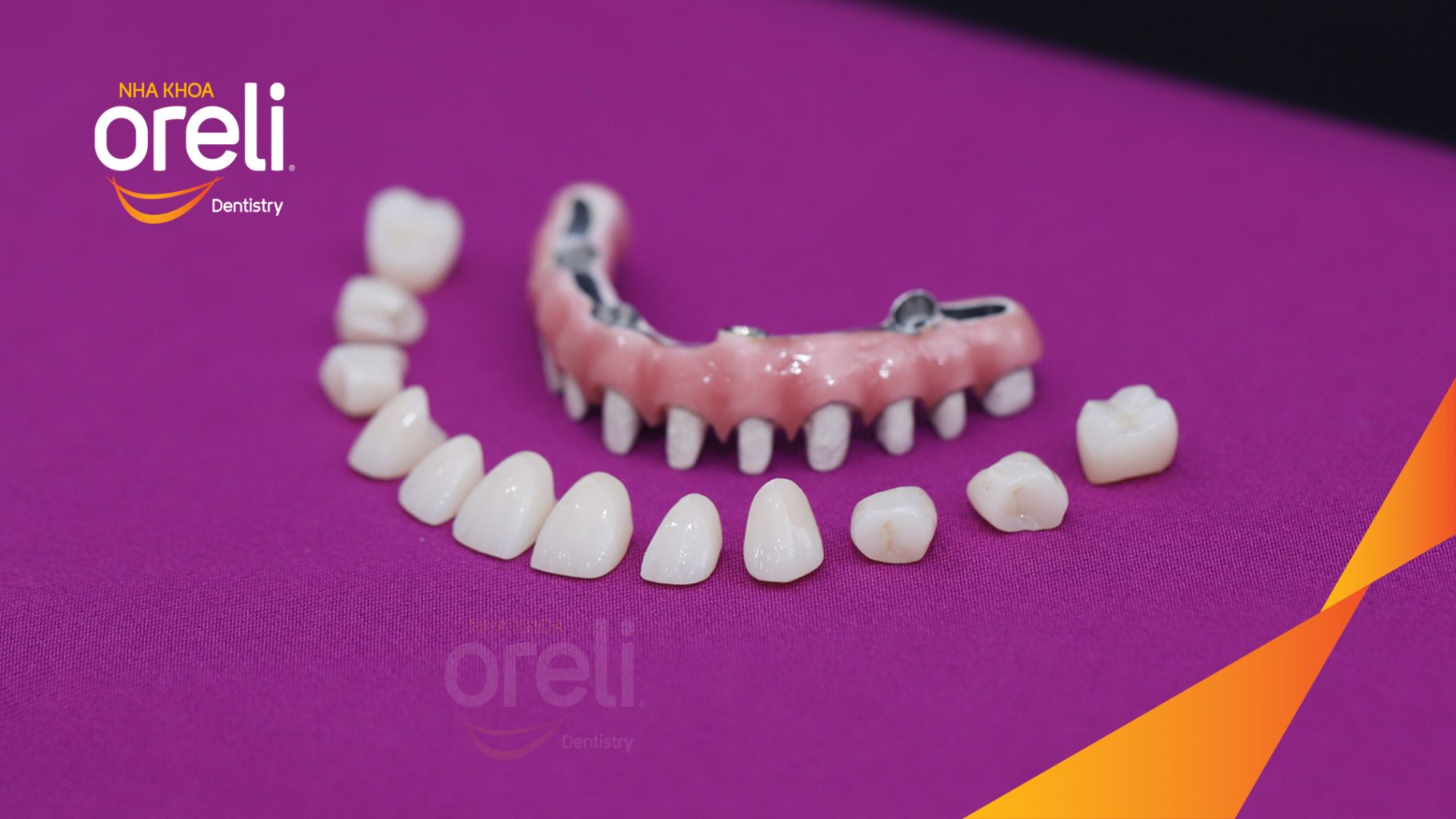  trước khi điều trị tại Oreli