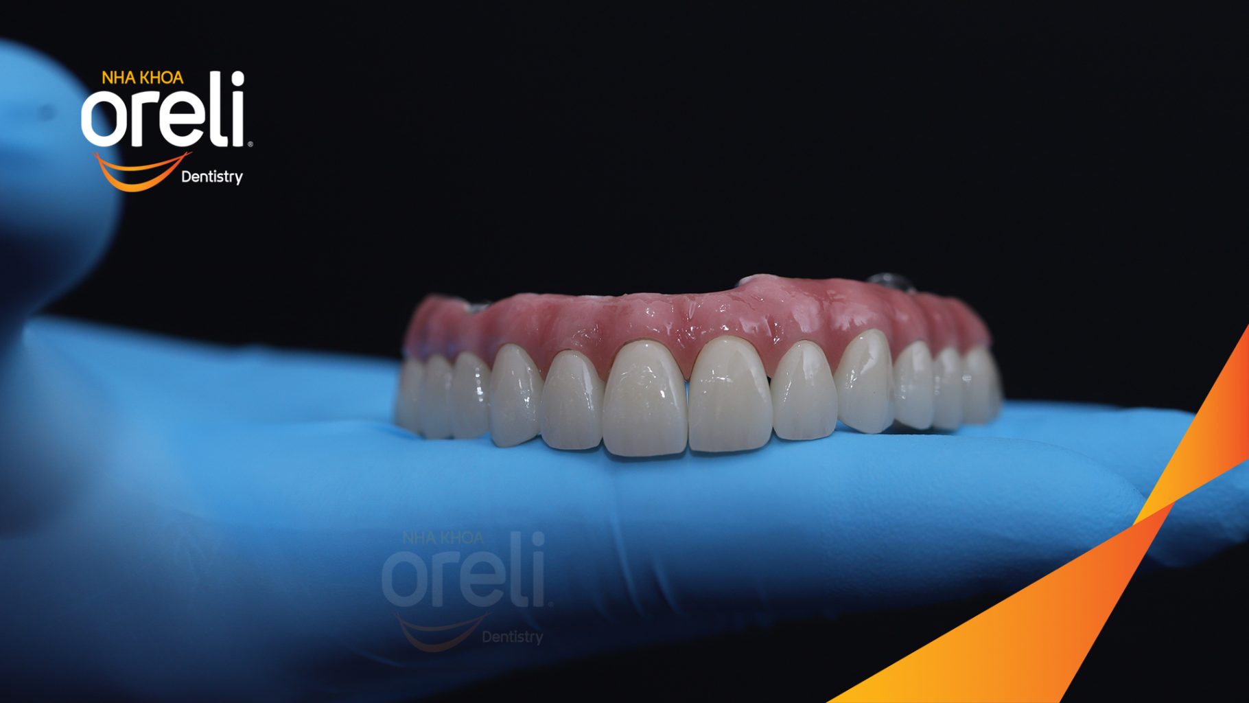 Trước điều trị:  tại Oreli