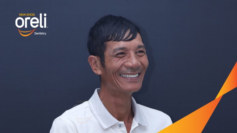 Ca trồng răng all on four hàm trên cho nụ cười đẹp ở Nha Khoa Oreli