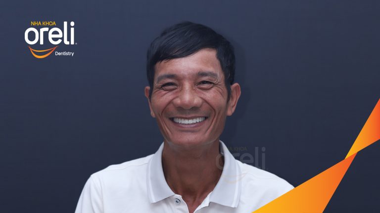 Ca trồng răng all on four hàm trên cho nụ cười đẹp ở Nha Khoa Oreli