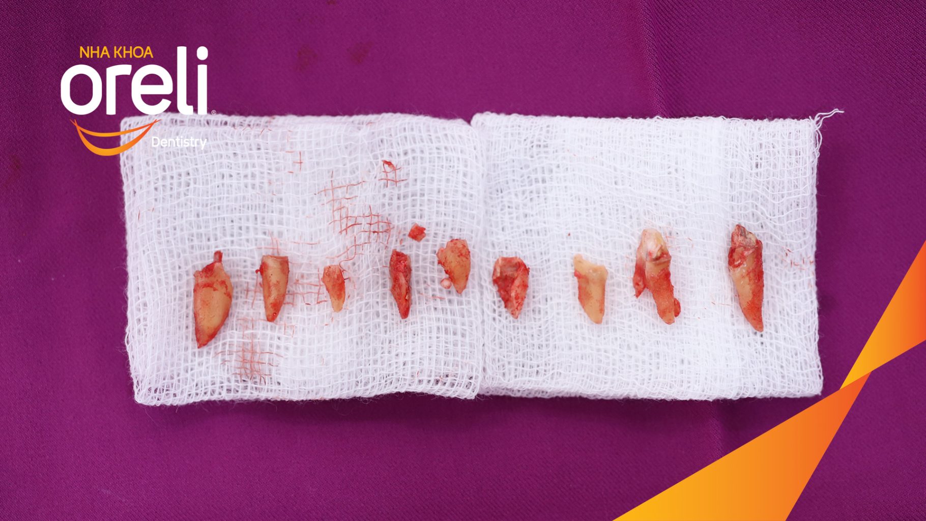 Quá trình  trong  tại Oreli