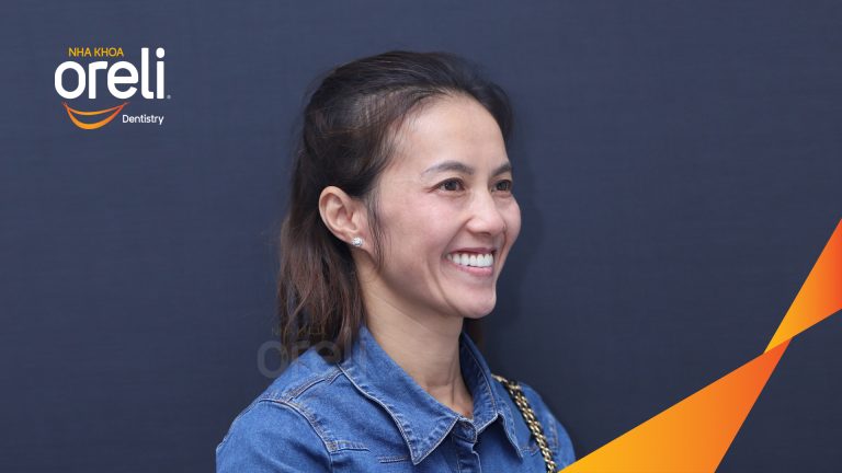 Ca trồng răng Implant all on four hàm trên – Phục hồi ăn nhai chắc chắn | Oreli