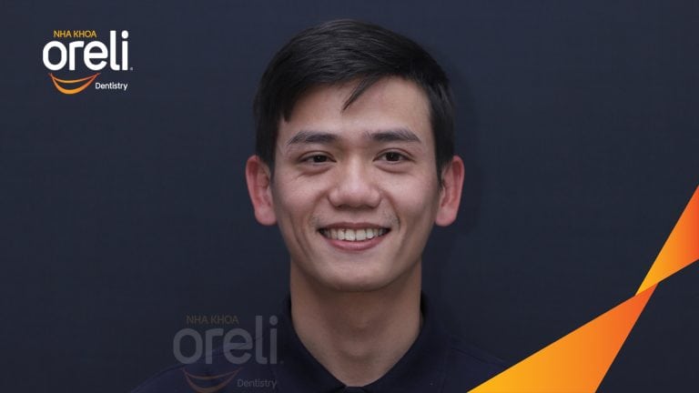 Niềng di gần răng 7 8 thay thế răng 6 hàm dưới bên phải