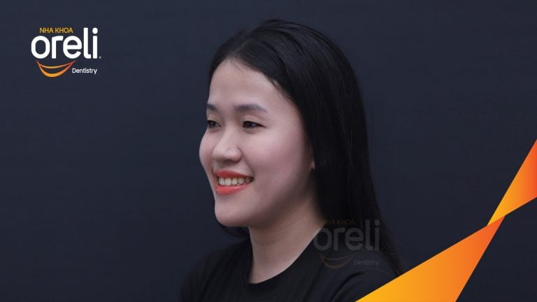 Niềng răng lệch khớp cắn tại Buôn Ma Thuột – Hành trình thay đổi nụ cười tại Nha khoa Oreli