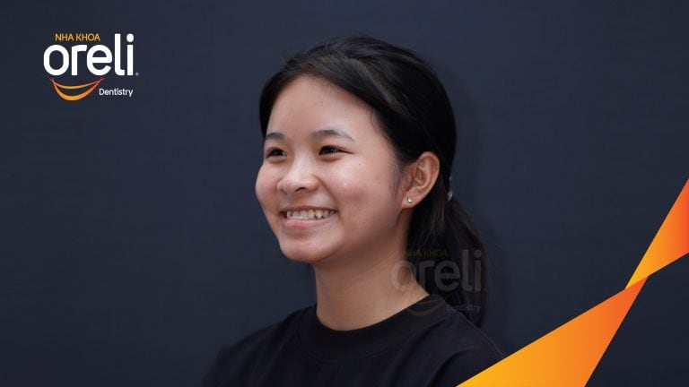 Ca niềng chỉnh cắn ngược hàm trên kết quả sau 18 tháng tại Oreli