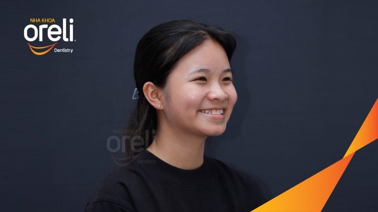 Ca niềng chỉnh cắn ngược hàm trên kết quả sau 18 tháng tại Oreli