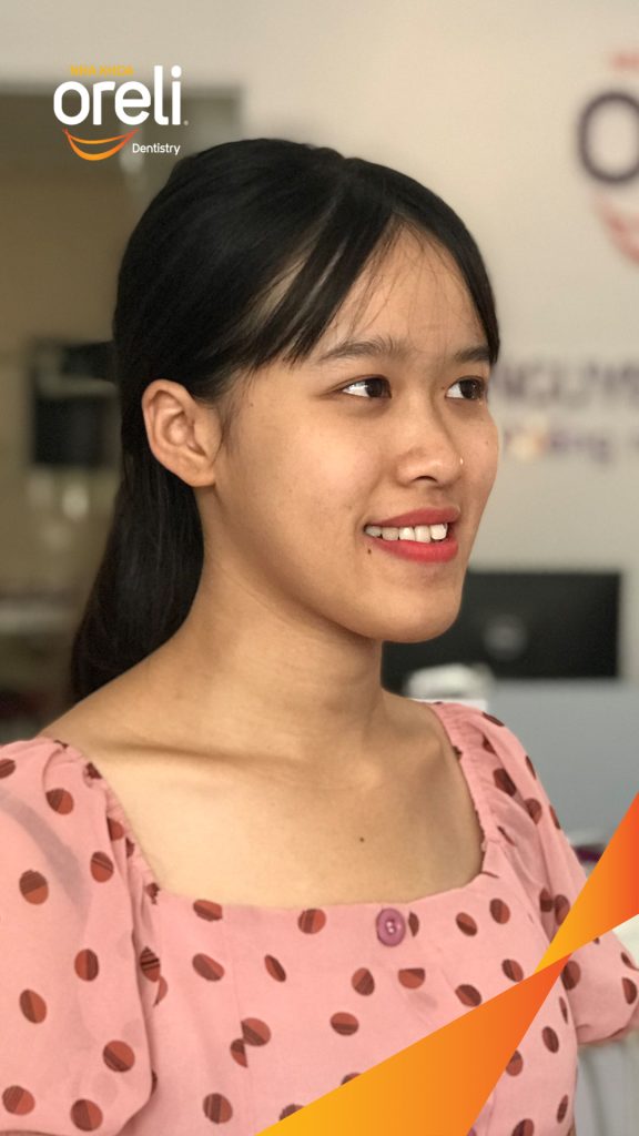 Kết quả sau :  tại Oreli