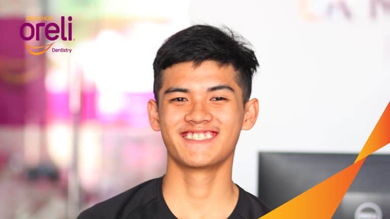 Ca niềng răng sai khớp cắn hạng 3 móm chen chúc kèm di gần răng số 7 8 thay thế răng 6 ở Oreli