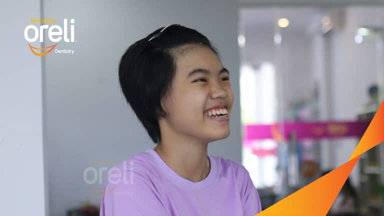 Ca niềng chỉnh hô cho nụ cười đẹp chuẩn smile design ở Oreli