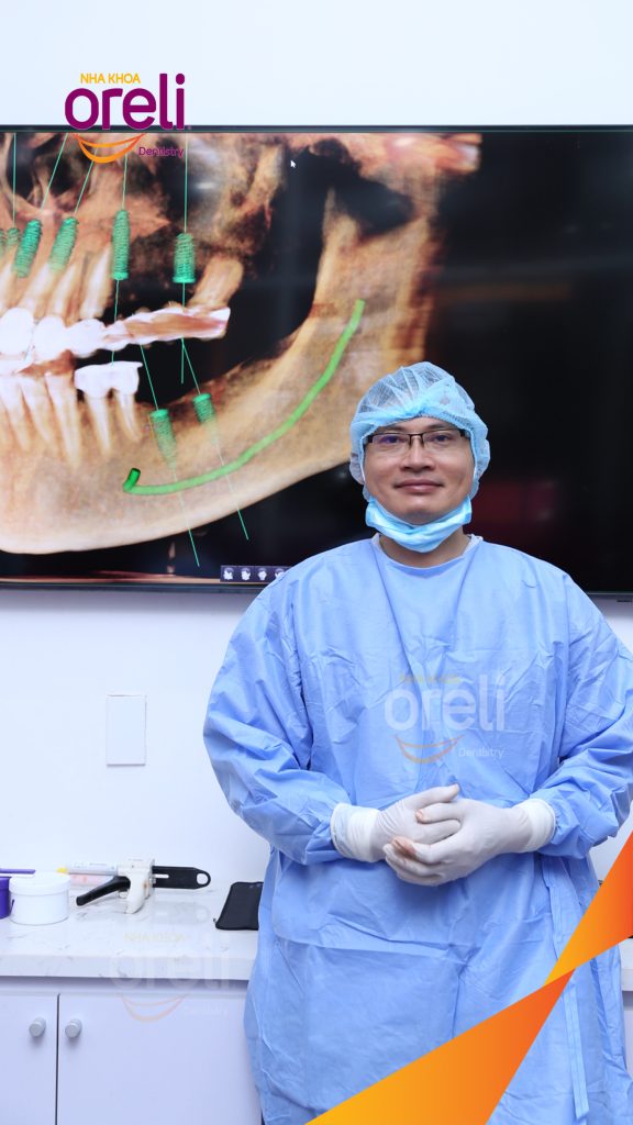 Cầu răng sứ hàm trên lâu ngày gãy, viêm nướu, chân răng lung lay trước khi điều trị tại Nha khoa Oreli