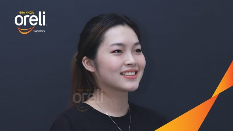 Trước – Sau niềng răng hô: Thay đổi rõ sau 24 tháng tại nha khoa Oreli