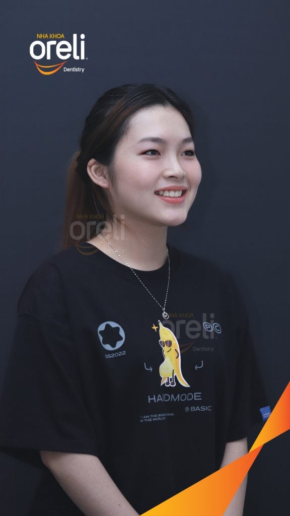 Kết quả đạt được sau 24 tháng - Nụ cười hài hòa, mặt nghiêng đẹp, trục răng cửa đứng tại Nha khoa Oreli