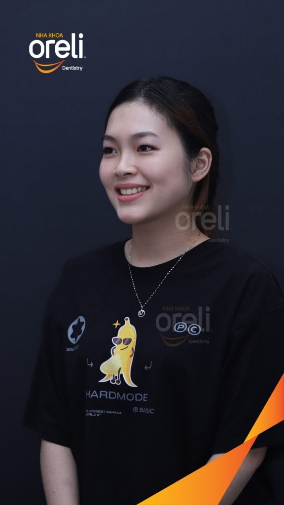 Nhô xương ổ, trục răng nghiêng trước hai hàm, độ nhô môi nhiều trước khi điều trị tại Nha khoa Oreli