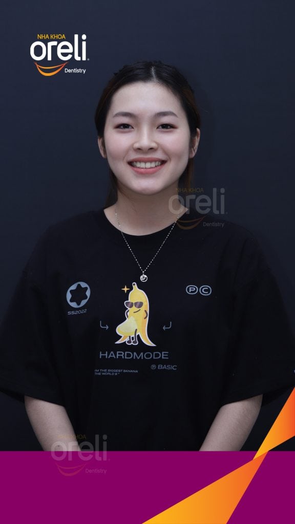 Thực hiện Nhổ răng 4 chỉnh hô kéo dài 24 tháng tại Nha khoa Oreli