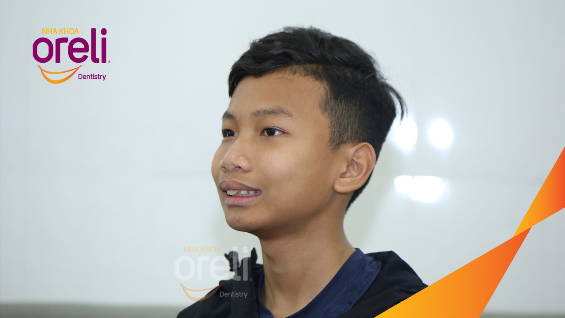 Kết quả đạt được sau 3 năm - Trục răng cửa thẳng đẹp, khớp cắn đúng tại Nha khoa Oreli