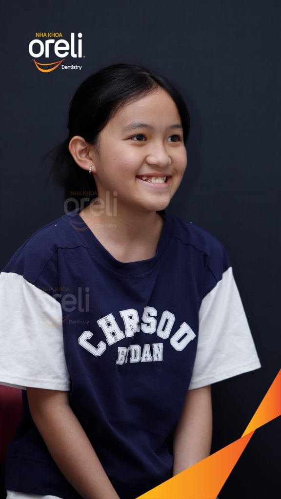Kết quả sau 2 năm: Mặt nghiêng hết móm, khớp cắn đúng, nụ cười cải thiện rõ rệt tại Nha khoa Oreli Buôn Hồ