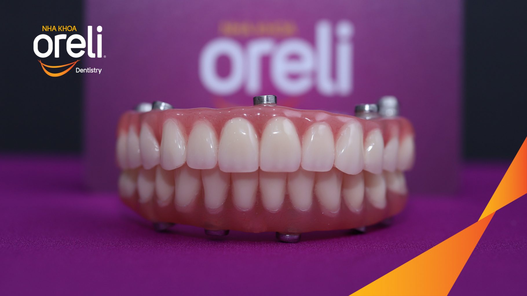 Kết quả đạt được sau 2 tuần - Chị khách cười nói tự tin và ăn nhai chắc chắn tại Nha khoa Oreli