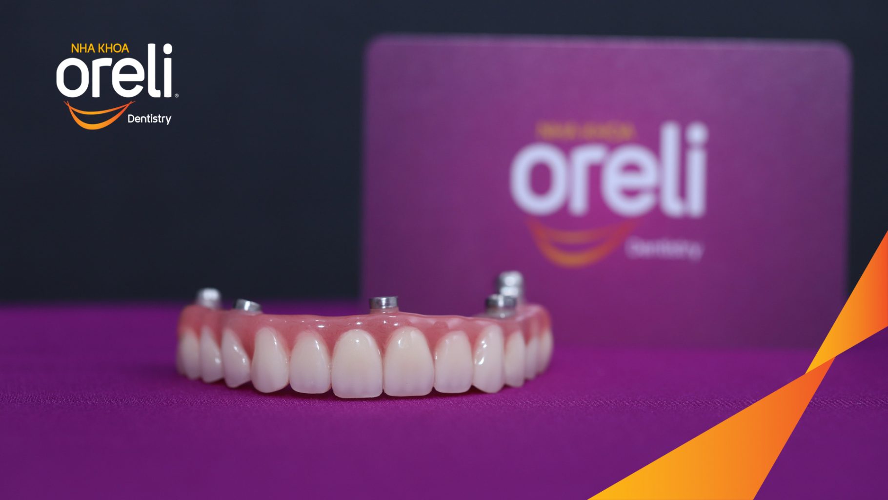 Kết quả sau 2 tuần: Chị khách cười nói tự tin và ăn nhai chắc chắn tại Nha khoa Oreli