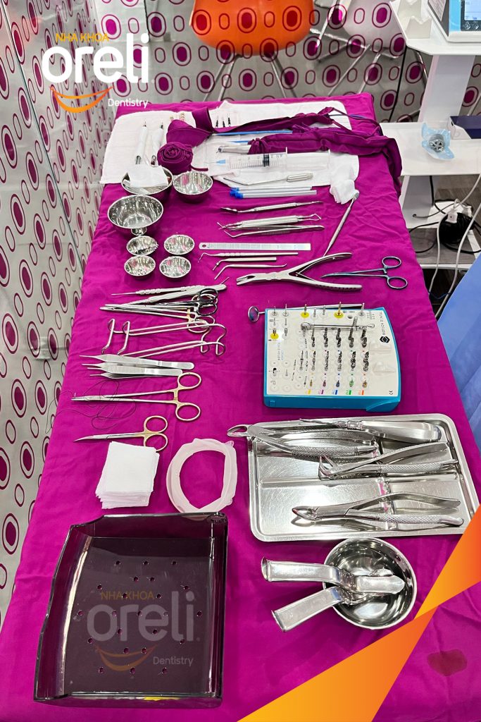 Quá trình Cắt bỏ cầu răng nhổ các chân răng trồng implant all on six trong 1 tuần tại Nha khoa Oreli