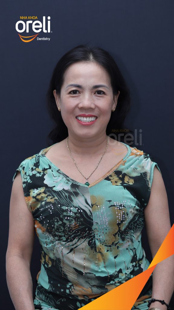 Kết quả đạt được sau 1 tuần - Thẩm mỹ tự nhiên ăn nhai chắc chắn tại Nha khoa Oreli