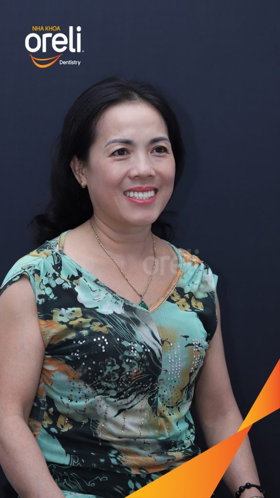 Trước điều trị: Cầu răng sứ hàm trên lung lay, các chân răng cũ tiêu xương tại Nha khoa Oreli