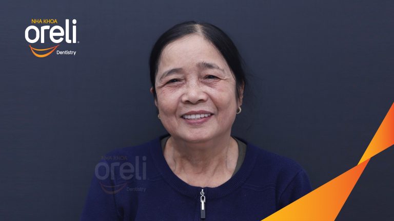 Ca trồng răng implant hai hàm cho mất răng toàn bộ | Nha khoa Oreli