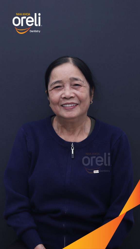 Thực hiện Nhổ răng toàn bộ các răng còn lại do lung lay mất khả năng hồi phục kéo dài 2 tuần tại Nha khoa Oreli