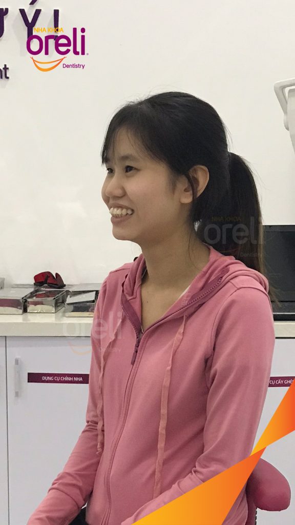 Kết quả sau 3 năm: Nụ cười thẩm mỹ hài hòa, khớp cắn đẹp tại Nha khoa Oreli
