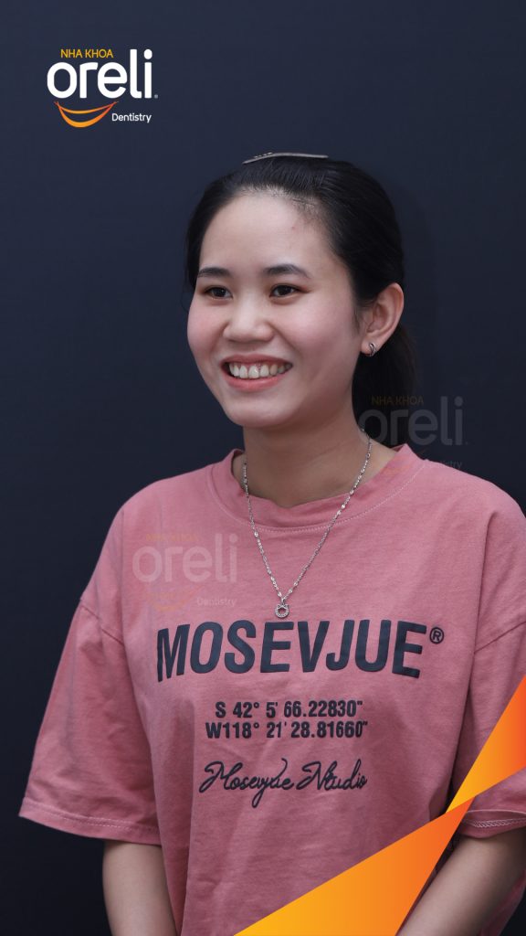 Kết quả đạt được sau 3 năm - Nụ cười thẩm mỹ hài hòa, khớp cắn đẹp tại Nha khoa Oreli