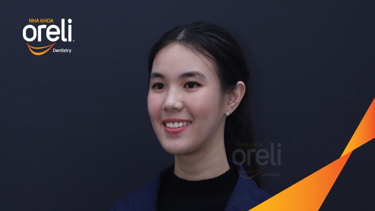 Ca niềng răng chen chúc sai khớp cắn hạng 3 cho nụ cười đẹp ở Nha Khoa Oreli