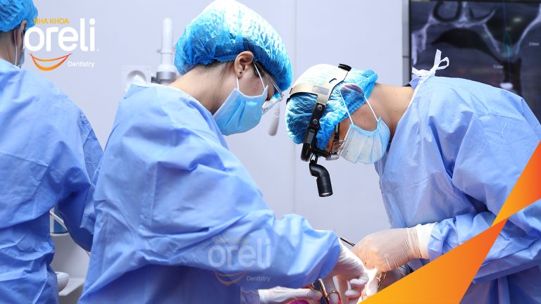 Ca Cấy Ghép Implant Hàm Dưới – Case thực tế tại Oreli