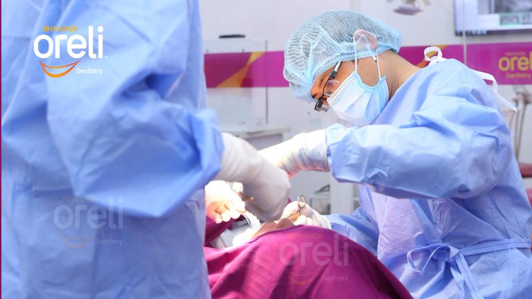 Ca Cấy Ghép Implant Hàm Dưới – Case thực tế tại Oreli