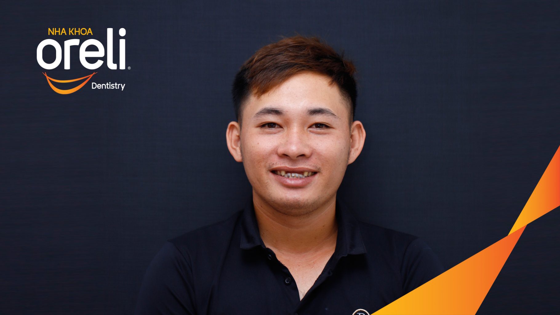 Kết quả sau 3 tháng: Phục hồi răng mất - ăn nhai chắc chắn và cười nói tự tin tại Oreli