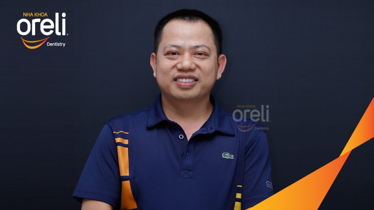Dán sứ Veneer tại Nha khoa Oreli