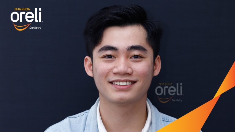 Dán sứ Veneer tại Buôn Ma Thuột | Nha khoa Oreli