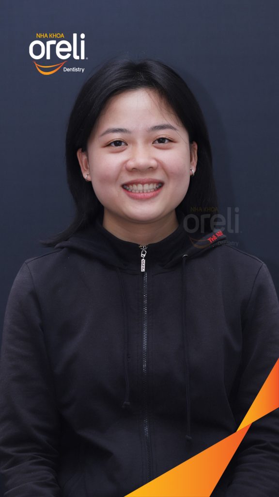Kết quả đạt được sau 3 năm - Khớp cắn chuẩn nụ cười đẹp tại Nha khoa Oreli