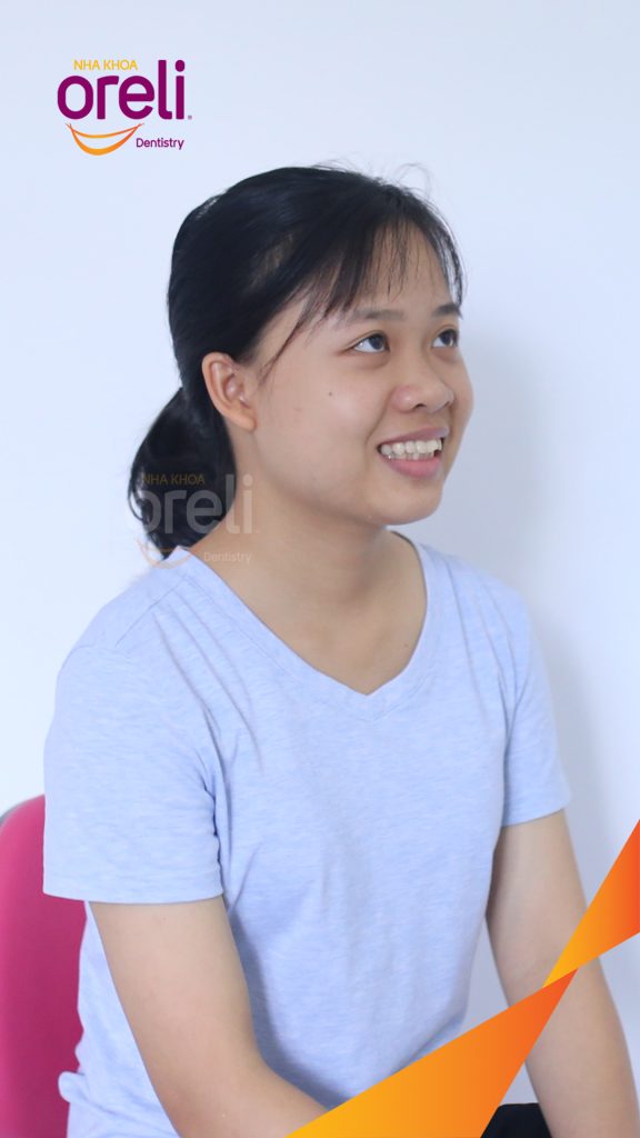 Trước điều trị: Răng chen chúc khấp khểnh hô tại Nha khoa Oreli