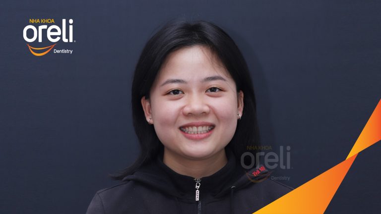 Ca niềng răng hô chen chúc nhổ 4r4 cho nụ cười đẹp ở Oreli