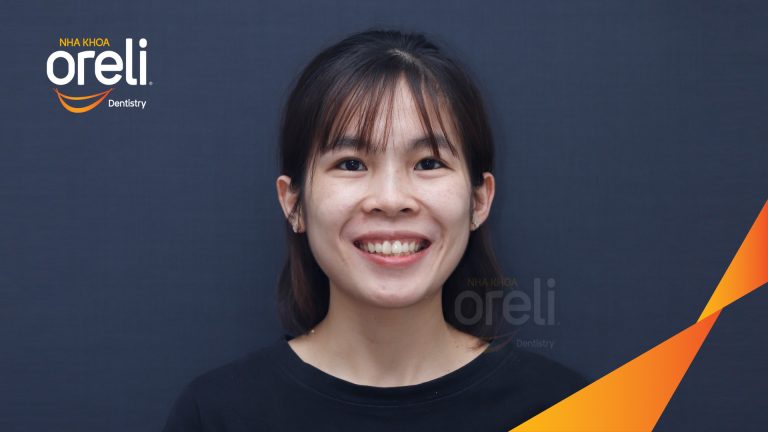 Niềng răng không nhổ răng cho nụ cười đẹp ở Oreli