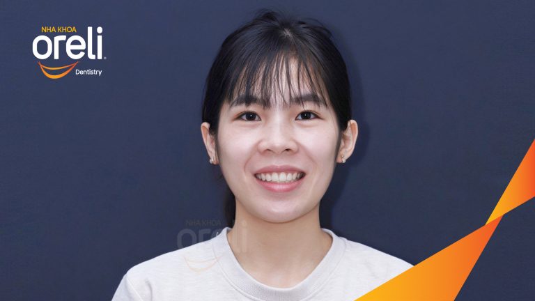 Niềng răng không nhổ răng cho nụ cười đẹp ở Oreli