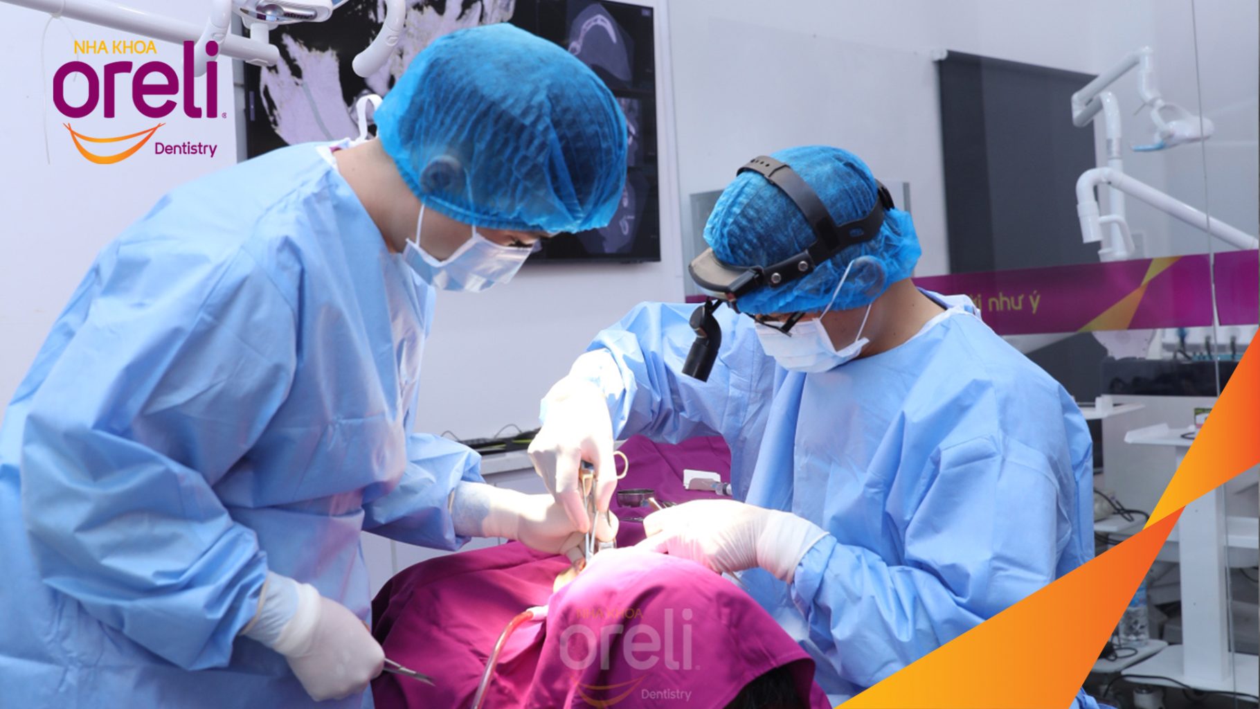 Quá trình Cấy ghép trụ Implant chính hãng vào vùng mất răng trong 3 tháng tại Oreli