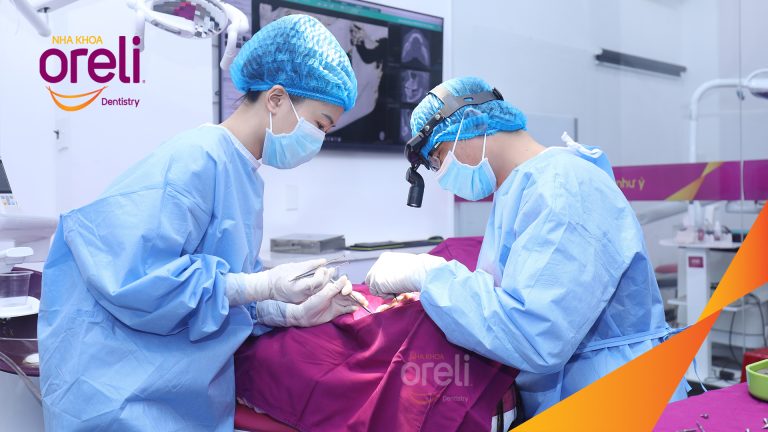 Ca Cấy Ghép Implant Hàm Dưới – Case thực tế tại Oreli