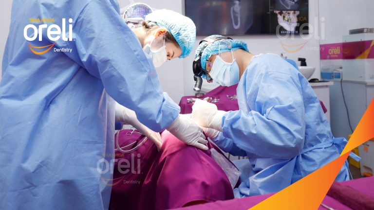 Ca Cấy Ghép Implant Hàm Trên – Case thực tế tại Oreli