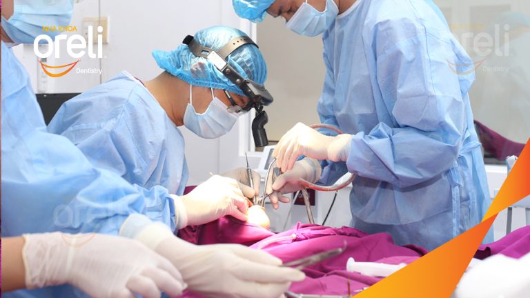Ca Cấy Ghép Implant Hàm Dưới – Case thực tế tại Oreli